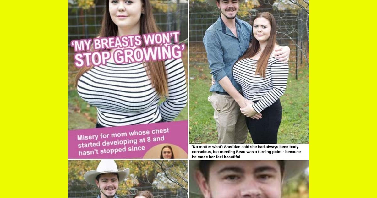 The Headline Is My Breasts Wont Stop Growing But What Makes It Is 