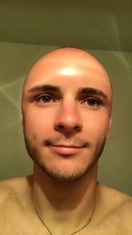 head shaved guy bald got sunburned badly fuck could he bit his so little