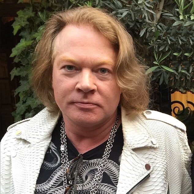 Axl Rose is slowly morphing into Benny Hill.